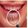 Implants Dentist - Cosmetic Dentist in Bayside, NY
