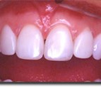 Oral_Surgery_in_Palmdale_CA.jpg