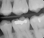 oral_surgeon_harker_heights_tx_cosmetic_dentist.jpg