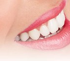 teeth_whitening_service_san_diego_dentist_periodontics.jpg
