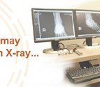 xray_urgenet_care_clinic_lincoln_NE.png